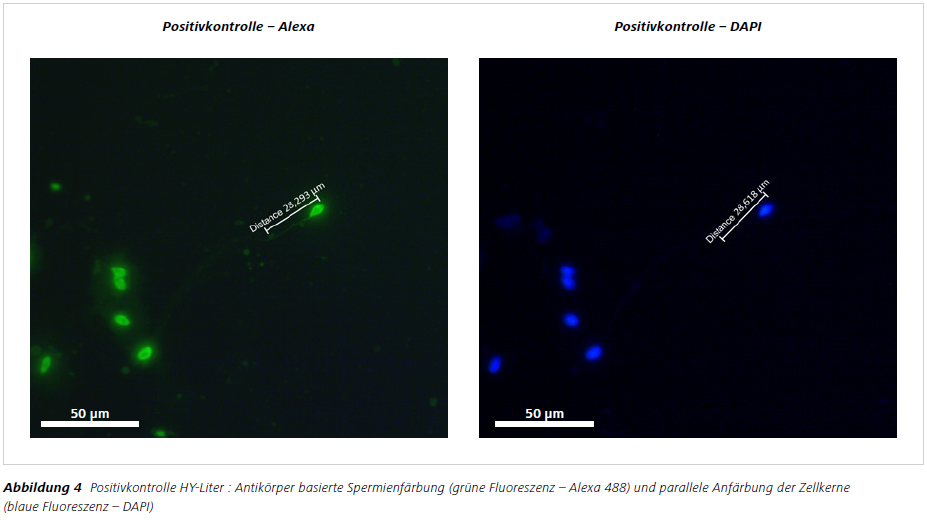 Abbildung 4 Positivkontrolle HY-Liter : Antikörper basierte Spermienfärbung (grüne Fluoreszenz – Alexa 488) und parallele Anfärbung der Zellkerne (blaue Fluoreszenz – DAPI)